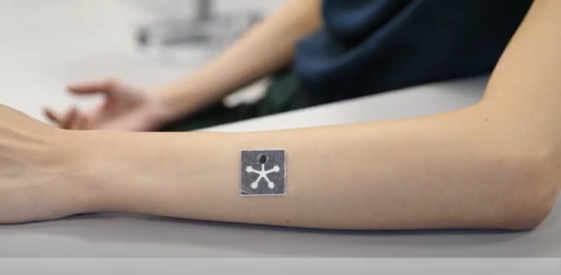 상처 치료와 모니터링이 가능한 배터리 없는 AI 지원 PETAL 센서 패치