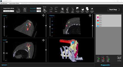 카비랩, AI 의료 영상 소프트웨어 '딥플랜에이' 사용 예시