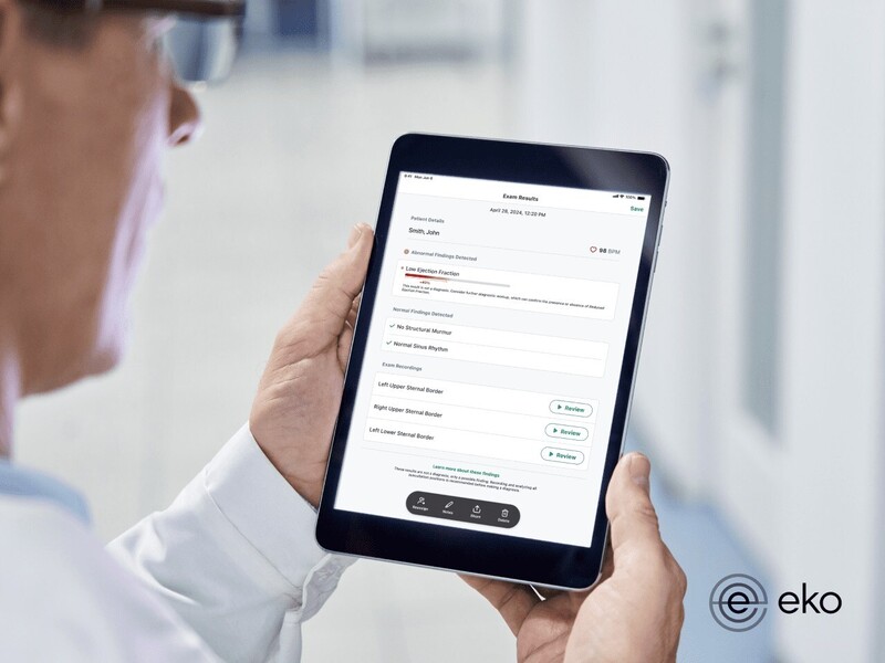 에코 헬스의 LEF AI를 사용하여 좌심실 박출률 감소가 있는 것으로 진단된 환자는 2년 동안 심장마비, 심부전, 입원 및 전인구 사망을 경험할 가능성이 두 배나 더 높았다.