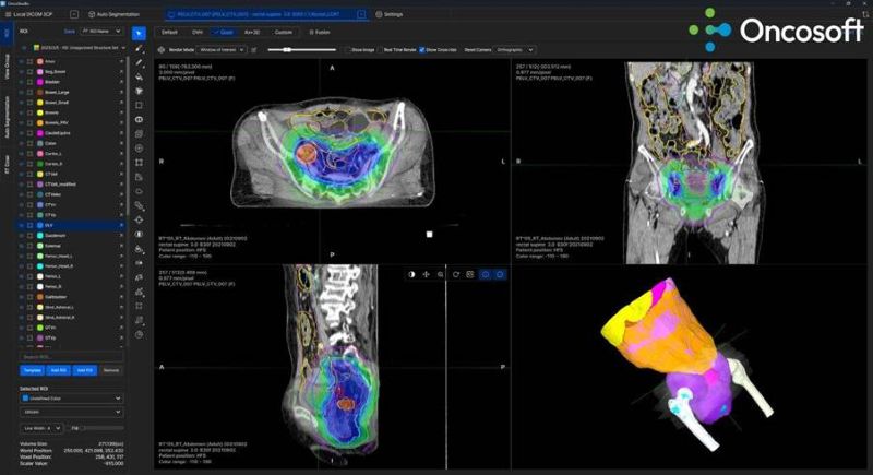 Qt의 프레임워크와 C++ 기반 플랫폼 적용된 온코소프트의 온코스튜디오